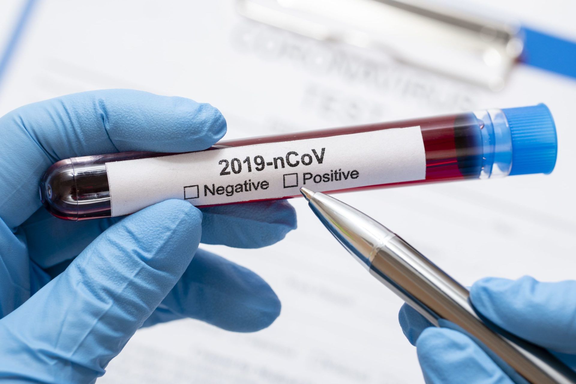 Medidas coronavirus RRHH